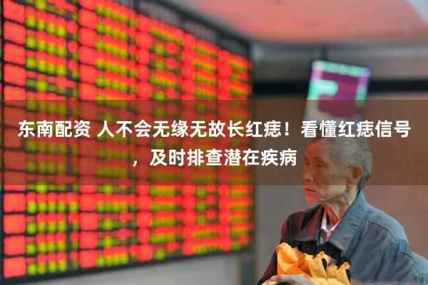 东南配资 人不会无缘无故长红痣！看懂红痣信号，及时排查潜在疾病